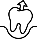 Problems after Tooth Extraction - Emergency dentist Redhill